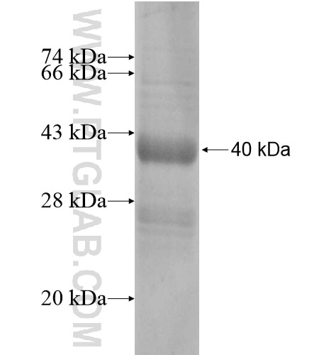 SLC37A2 fusion protein Ag14306 SDS-PAGE
