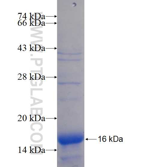 SLC37A2 fusion protein Ag14806 SDS-PAGE