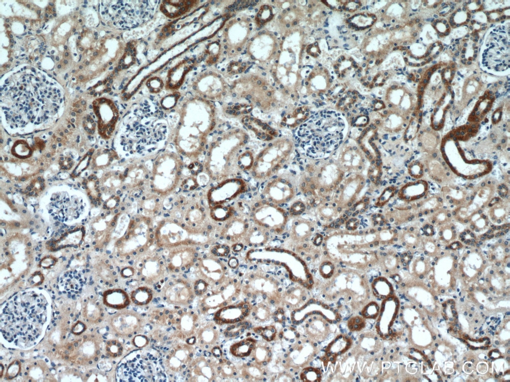 Immunohistochemistry (IHC) staining of human kidney tissue using SLC37A4 Polyclonal antibody (20612-1-AP)