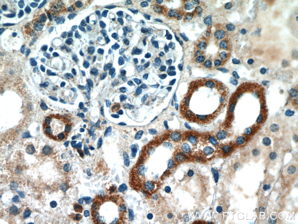 Immunohistochemistry (IHC) staining of human kidney tissue using SLC37A4 Polyclonal antibody (20612-1-AP)