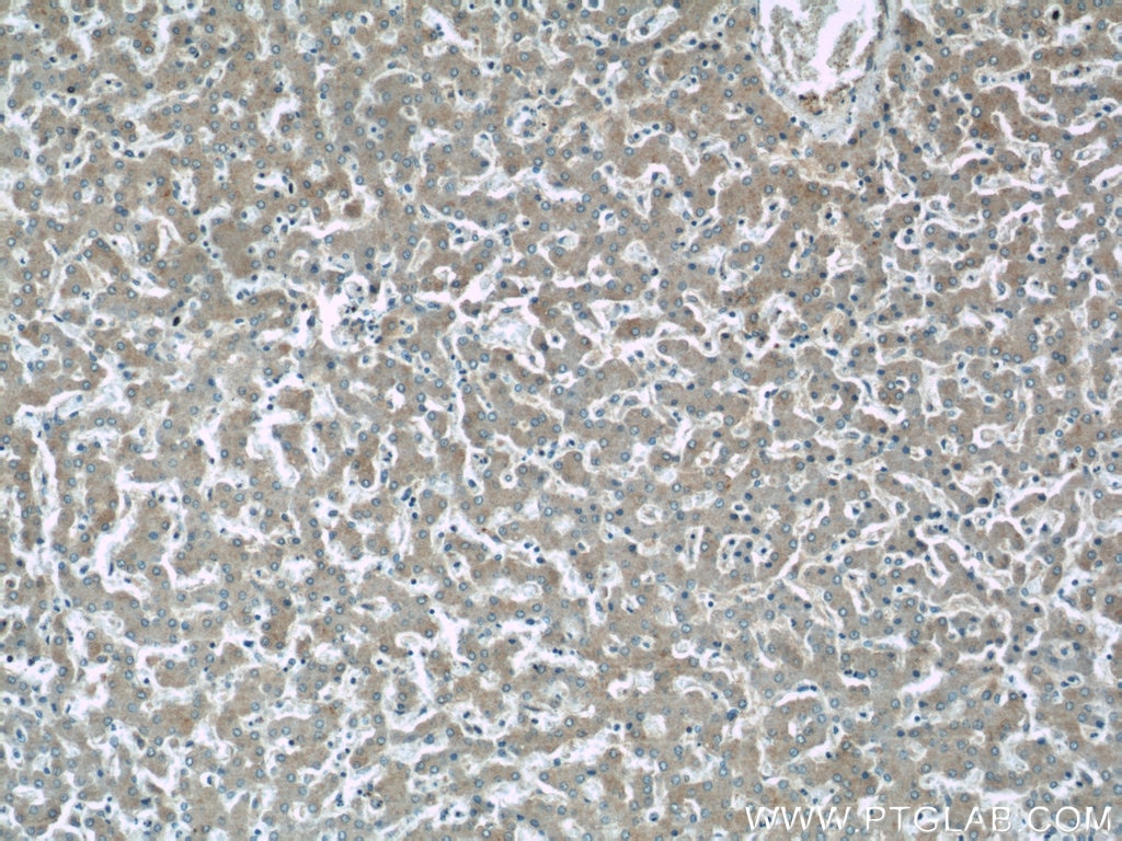 Immunohistochemistry (IHC) staining of human liver tissue using SLC37A4 Polyclonal antibody (20612-1-AP)