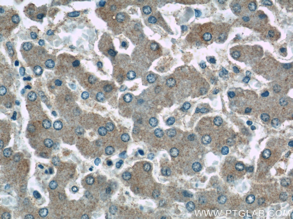 Immunohistochemistry (IHC) staining of human liver tissue using SLC37A4 Polyclonal antibody (20612-1-AP)