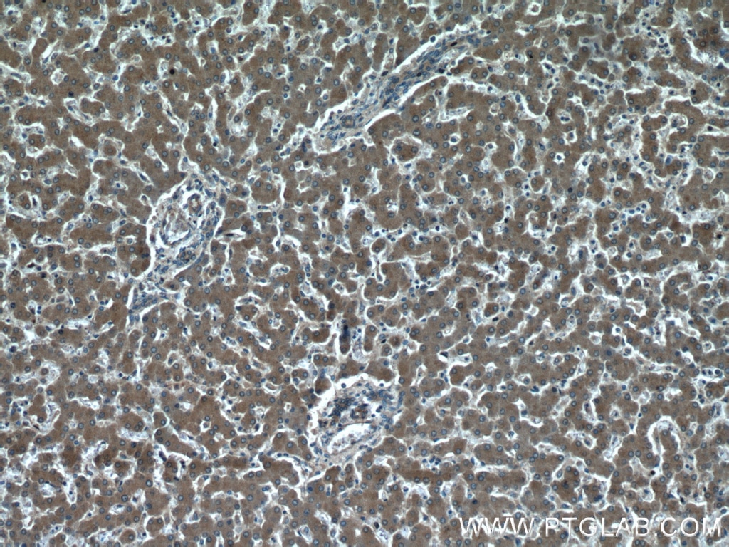 IHC staining of human liver using 20612-1-AP