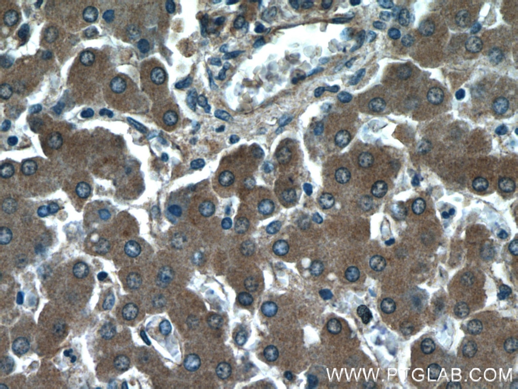 Immunohistochemistry (IHC) staining of human liver tissue using SLC37A4 Polyclonal antibody (20612-1-AP)