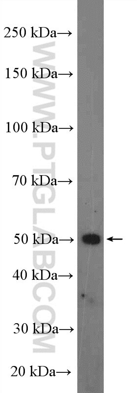 Western Blot (WB) analysis of HeLa cells using SLC37A4 Polyclonal antibody (20612-1-AP)