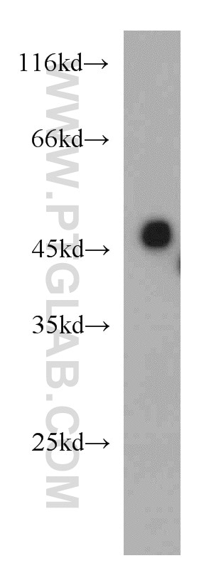 WB analysis of mouse kidney using 20612-1-AP