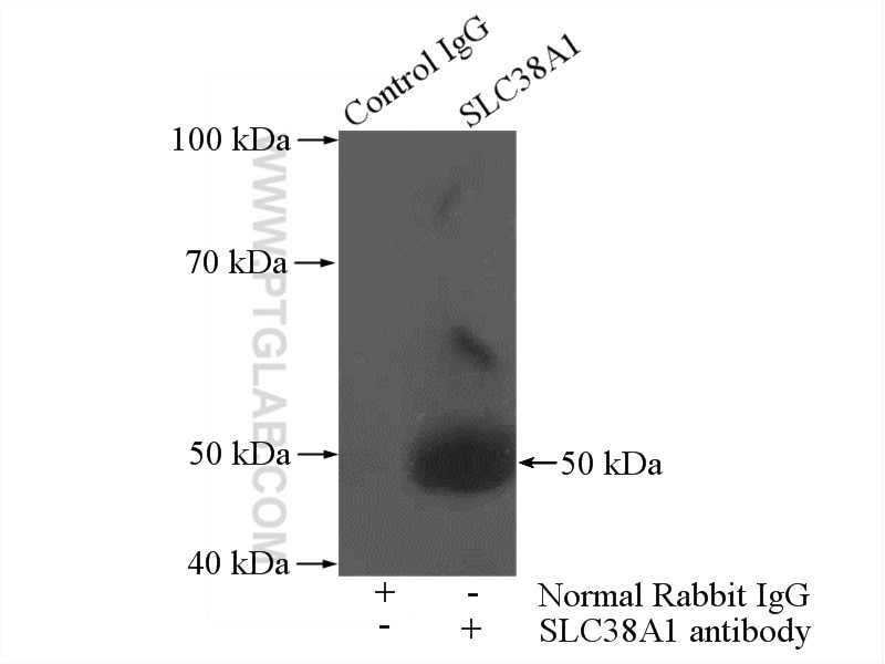 Immunoprecipitation (IP) experiment of mouse brain tissue using SLC38A1 Polyclonal antibody (12039-1-AP)