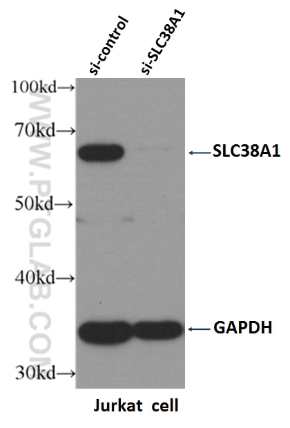 Western Blot (WB) analysis of Jurkat cells using SLC38A1 Polyclonal antibody (12039-1-AP)