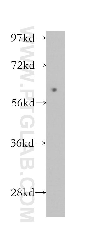 Western Blot (WB) analysis of human kidney tissue using SLC38A1 Polyclonal antibody (12039-1-AP)