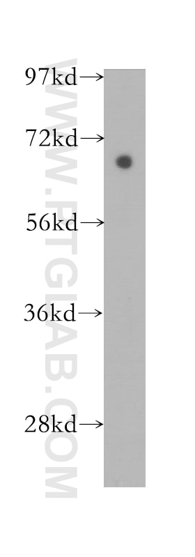 Western Blot (WB) analysis of Jurkat cells using SLC38A1 Polyclonal antibody (12039-1-AP)