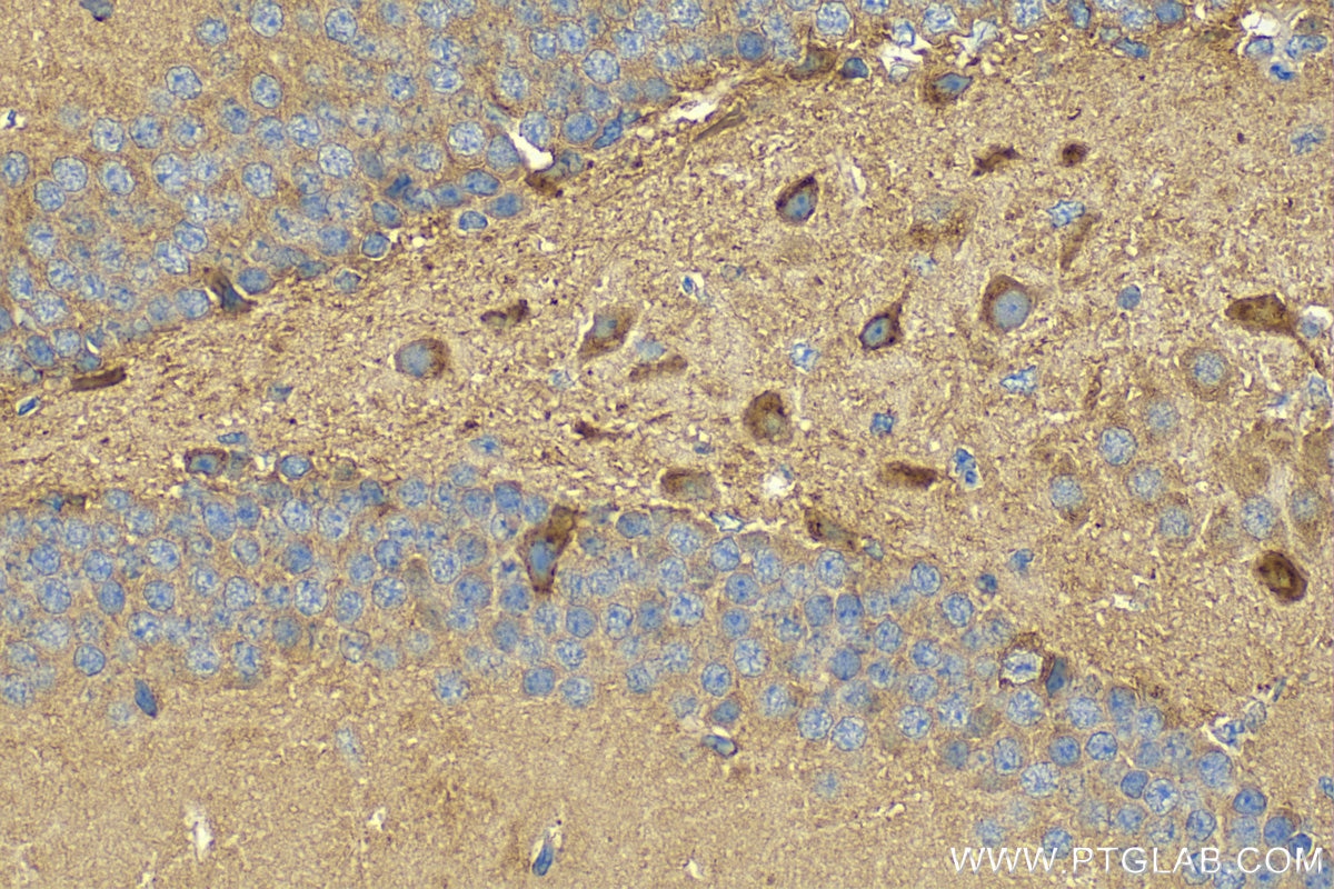 Immunohistochemistry (IHC) staining of mouse brain tissue using SLC38A1 Polyclonal antibody (28632-1-AP)
