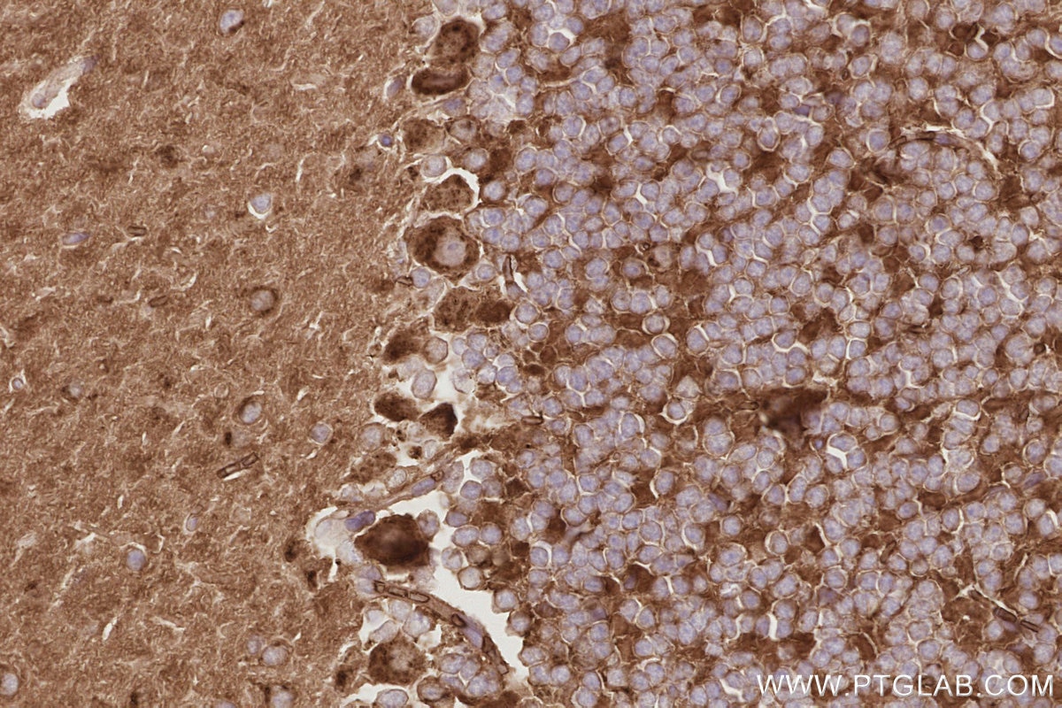 Immunohistochemistry (IHC) staining of mouse cerebellum tissue using SLC38A1 Polyclonal antibody (28632-1-AP)