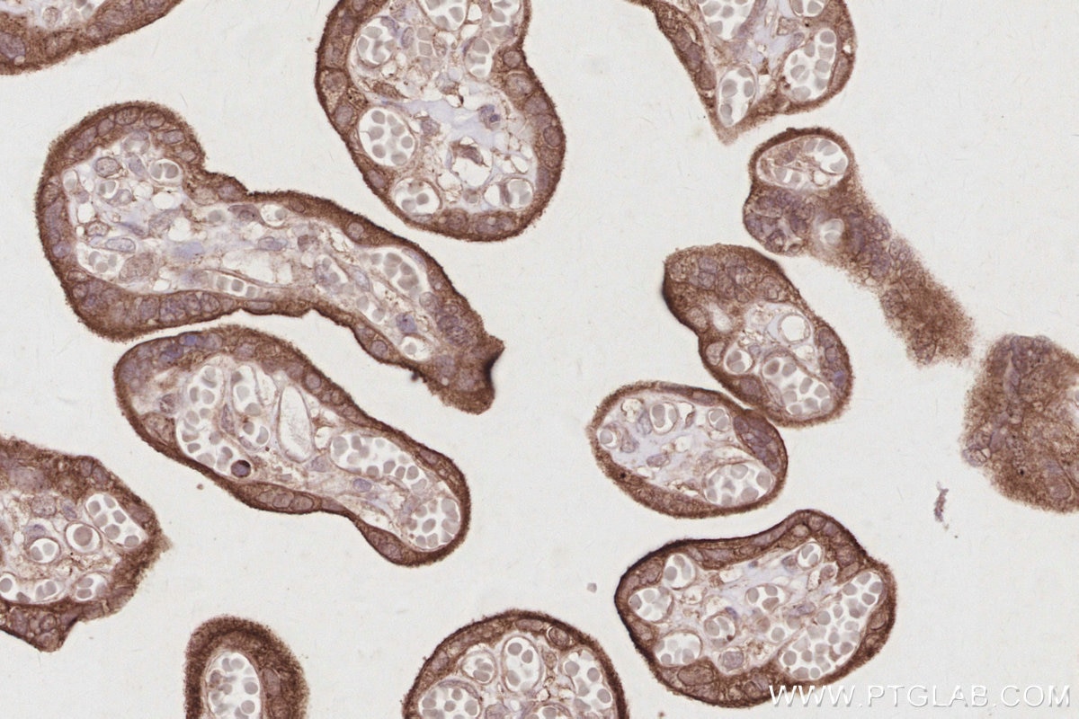 Immunohistochemistry (IHC) staining of human placenta tissue using SLC38A1 Polyclonal antibody (28632-1-AP)