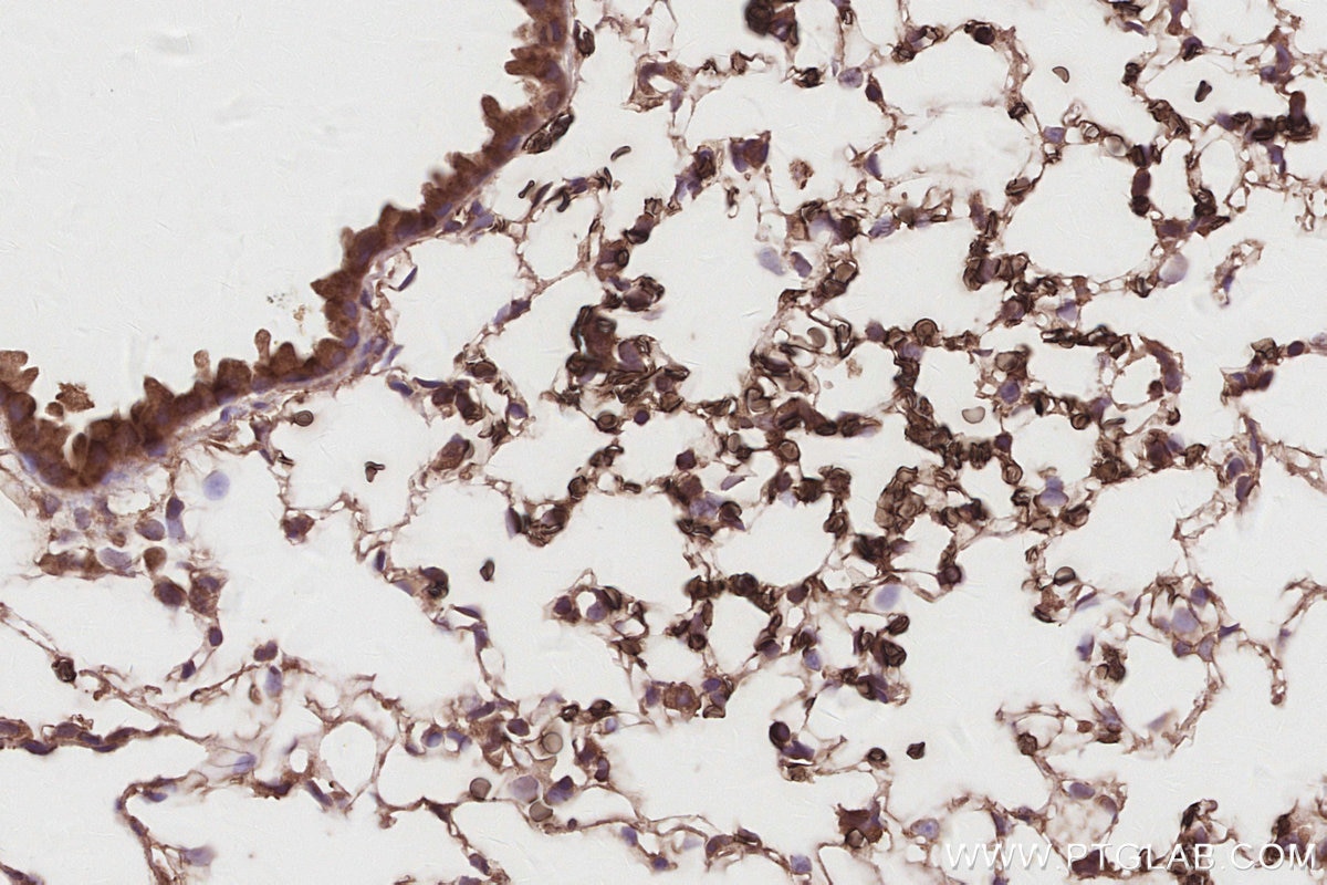 Immunohistochemistry (IHC) staining of mouse lung tissue using SLC38A1 Polyclonal antibody (28632-1-AP)