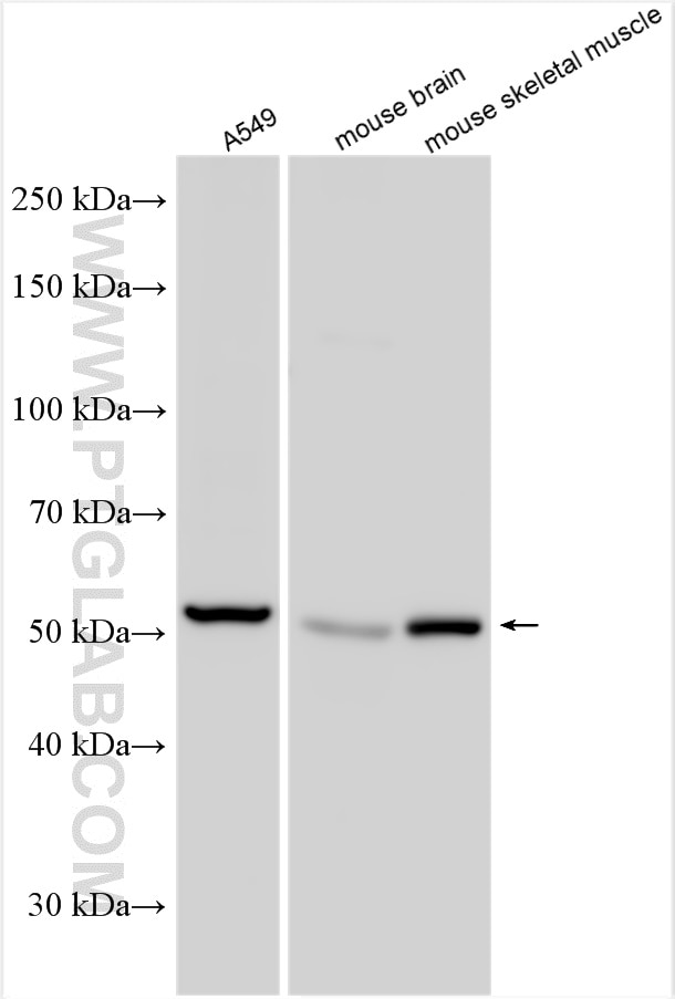 Western Blot (WB) analysis of various lysates using SLC38A1 Polyclonal antibody (28632-1-AP)