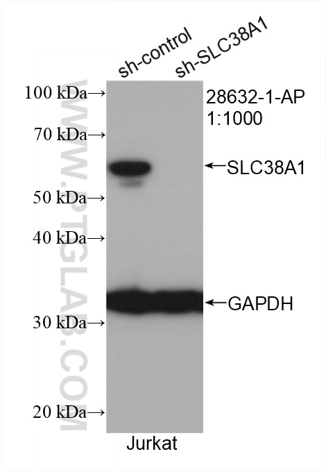 Western Blot (WB) analysis of HeLa cells using SLC38A1 Polyclonal antibody (28632-1-AP)