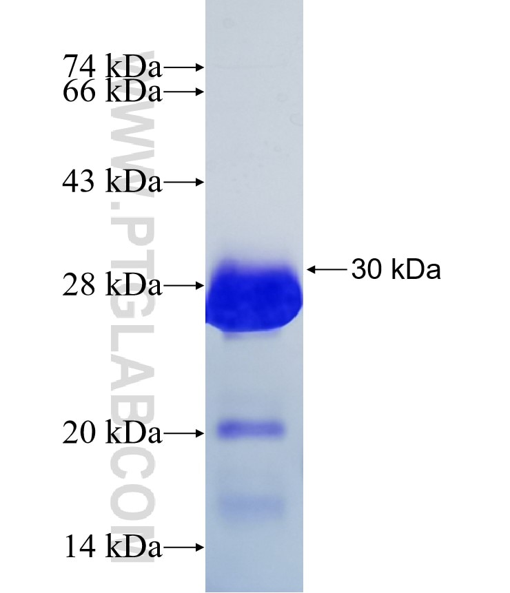 SLC38A10 fusion protein Ag25673 SDS-PAGE