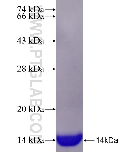 SLC38A2 fusion protein Ag28338 SDS-PAGE