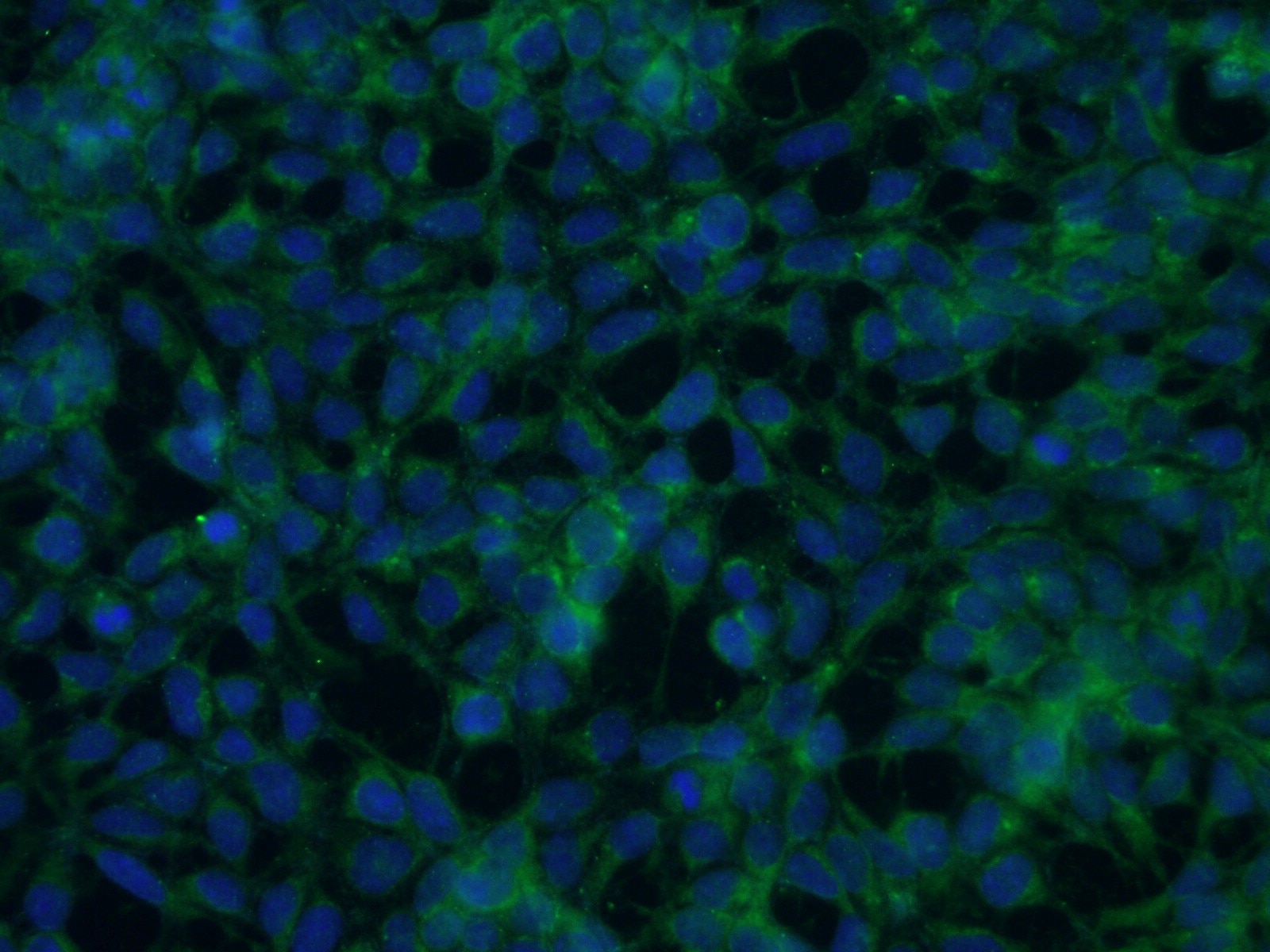 Immunofluorescence (IF) / fluorescent staining of HEK-293 cells using SLC38A3 Polyclonal antibody (14315-1-AP)
