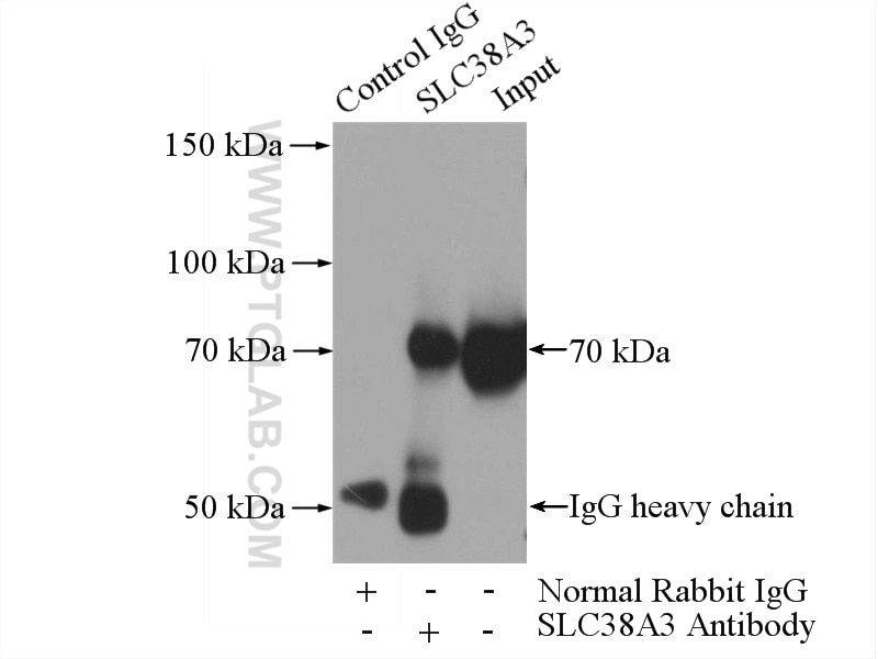 Immunoprecipitation (IP) experiment of mouse heart tissue using SLC38A3 Polyclonal antibody (14315-1-AP)