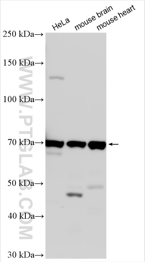 Western Blot (WB) analysis of various lysates using SLC38A3 Polyclonal antibody (14315-1-AP)