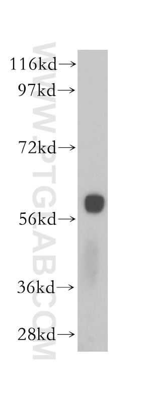 Western Blot (WB) analysis of mouse pancreas tissue using SLC38A3 Polyclonal antibody (14315-1-AP)