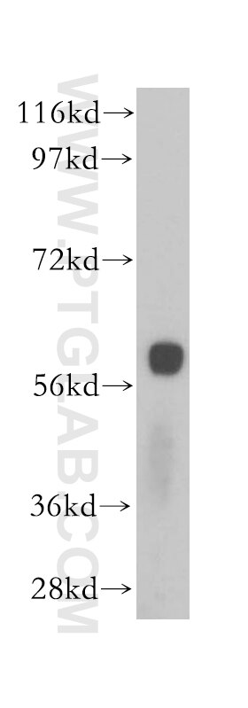 Western Blot (WB) analysis of mouse pancreas tissue using SLC38A3 Polyclonal antibody (14315-1-AP)