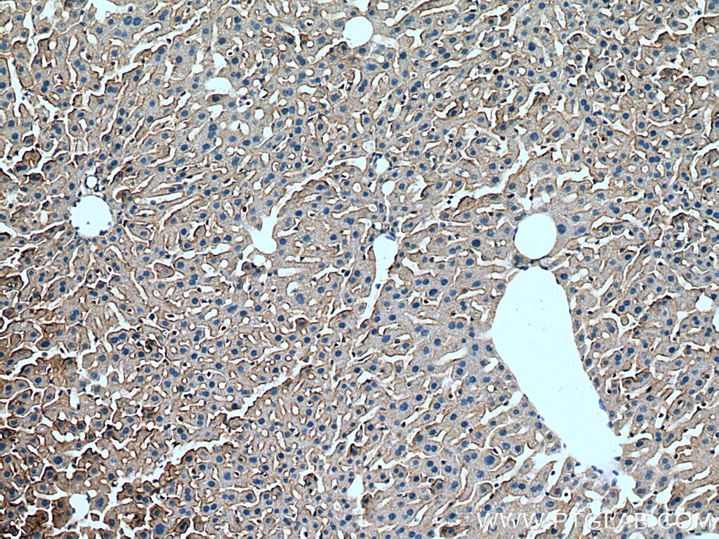 Immunohistochemistry (IHC) staining of mouse liver tissue using SLC38A4 Polyclonal antibody (20857-1-AP)