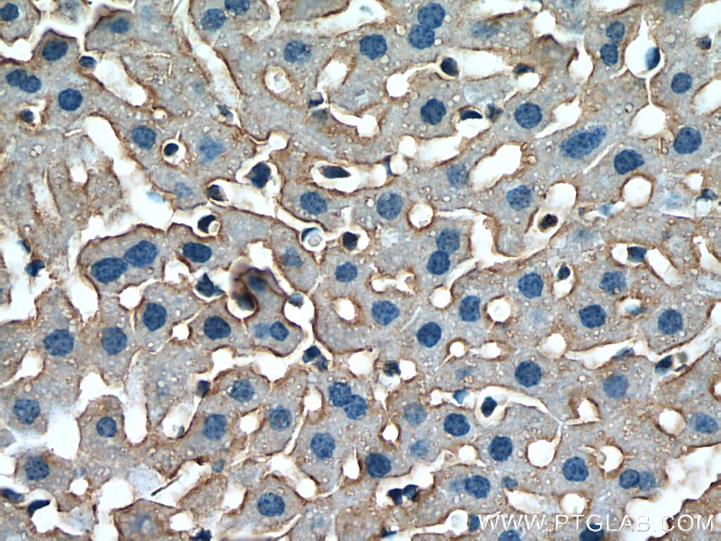 Immunohistochemistry (IHC) staining of mouse liver tissue using SLC38A4 Polyclonal antibody (20857-1-AP)