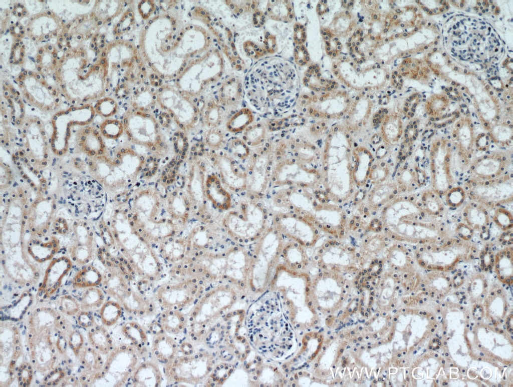 Immunohistochemistry (IHC) staining of human kidney tissue using SLC38A4 Polyclonal antibody (20857-1-AP)