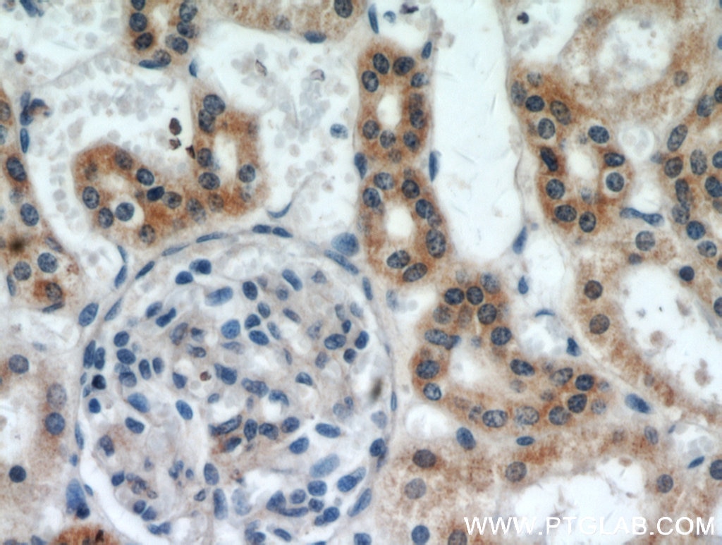 Immunohistochemistry (IHC) staining of human kidney tissue using SLC38A4 Polyclonal antibody (20857-1-AP)