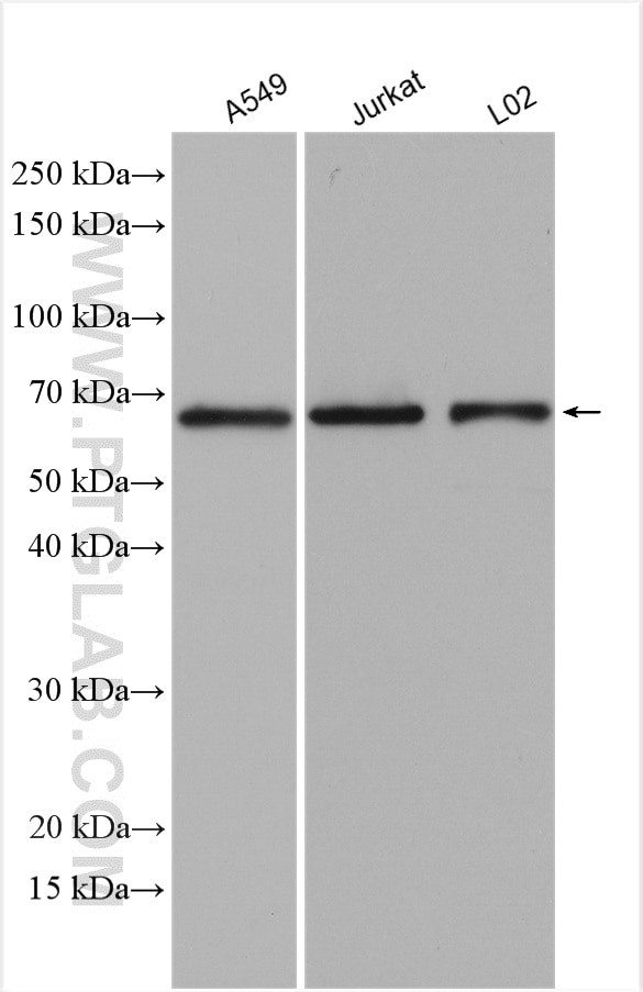 Western Blot (WB) analysis of various lysates using SLC38A4 Polyclonal antibody (20857-1-AP)