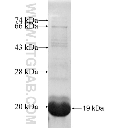 SLC38A4 fusion protein Ag14827 SDS-PAGE