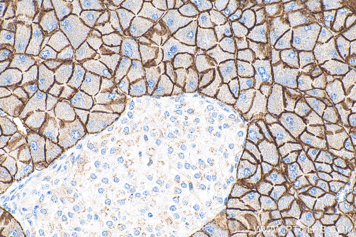 Immunohistochemistry (IHC) staining of mouse pancreas tissue using SLC38A5 Polyclonal antibody (28102-1-AP)