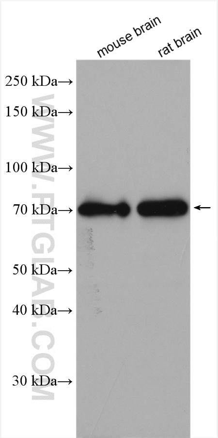 Western Blot (WB) analysis of various lysates using SLC38A5 Polyclonal antibody (28102-1-AP)