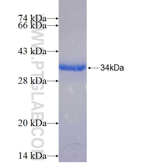 SLC38A5 fusion protein Ag24376 SDS-PAGE