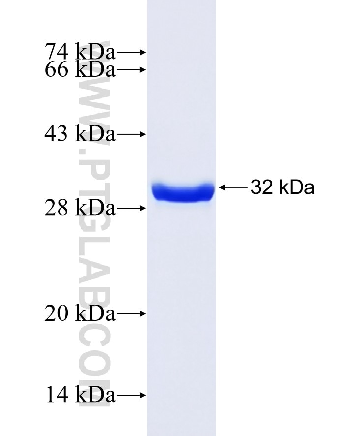 SLC38A5 fusion protein Ag27881 SDS-PAGE