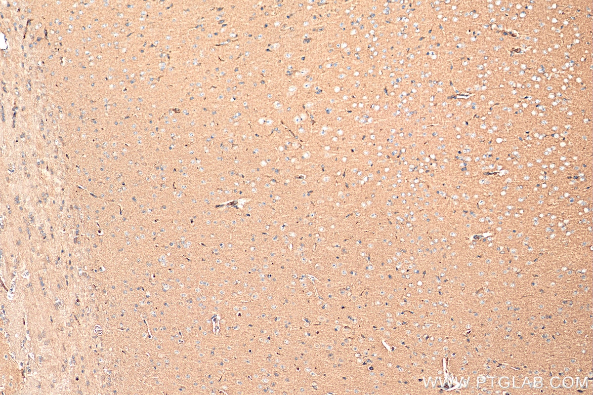 Immunohistochemistry (IHC) staining of mouse brain tissue using SLC38A6 Polyclonal antibody (27636-1-AP)