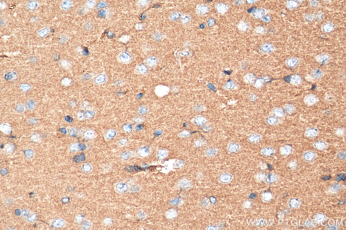 IHC staining of mouse brain using 27636-1-AP