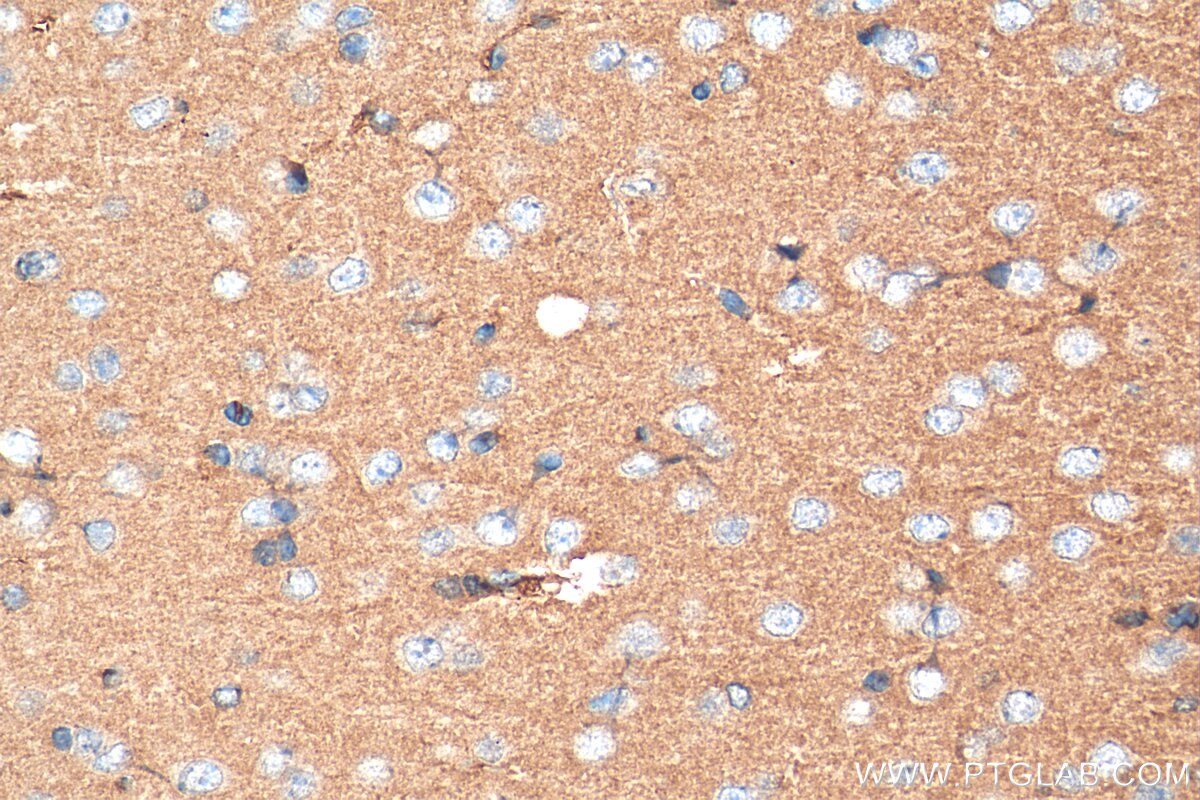 Immunohistochemistry (IHC) staining of mouse brain tissue using SLC38A6 Polyclonal antibody (27636-1-AP)