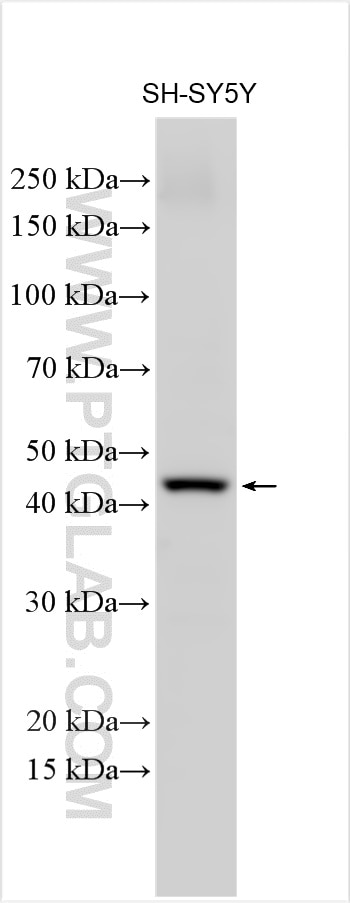 Western Blot (WB) analysis of SH-SY5Y cells using SLC38A6 Polyclonal antibody (27636-1-AP)