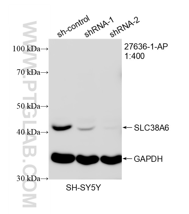WB analysis of SH-SY5Y using 27636-1-AP (same clone as 27636-1-PBS) Western Blot (WB) analysis of SH-SY5Y cells using SLC38A6 Polyclonal antibody (27636-1-AP)