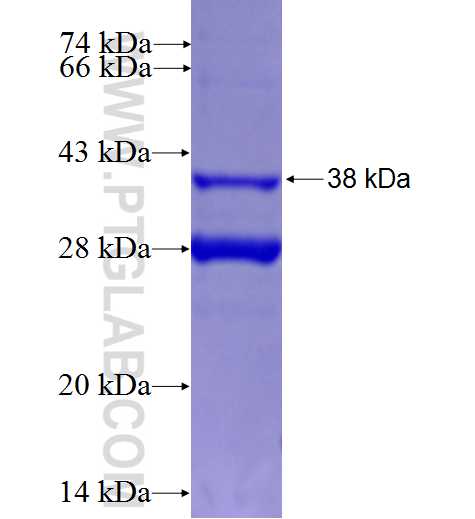 SLC38A6 fusion protein Ag24654 SDS-PAGE