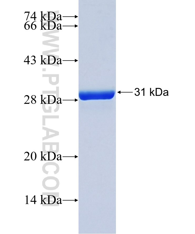 SLC38A6 fusion protein Ag37717 SDS-PAGE SLC38A6 fusion protein Ag37717 SDS-PAGE