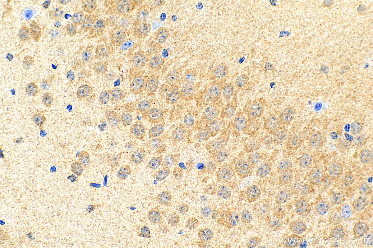 Immunohistochemistry (IHC) staining of mouse brain tissue using SLC38A7 Polyclonal antibody (31486-1-AP)