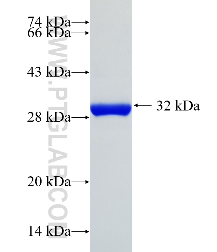 SLC38A7 fusion protein Ag35081 SDS-PAGE
