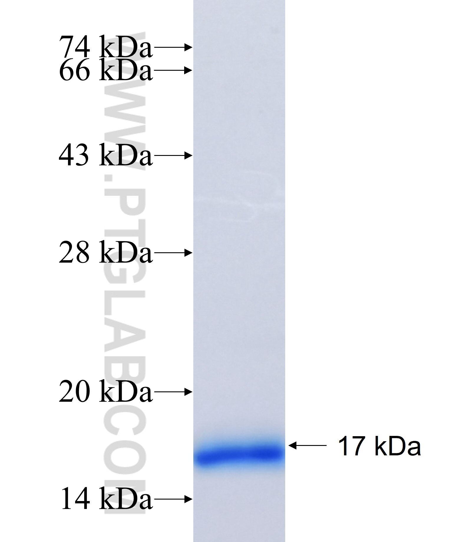 SLC38A7 fusion protein Ag35101 SDS-PAGE SLC38A7 fusion protein Ag35101 SDS-PAGE