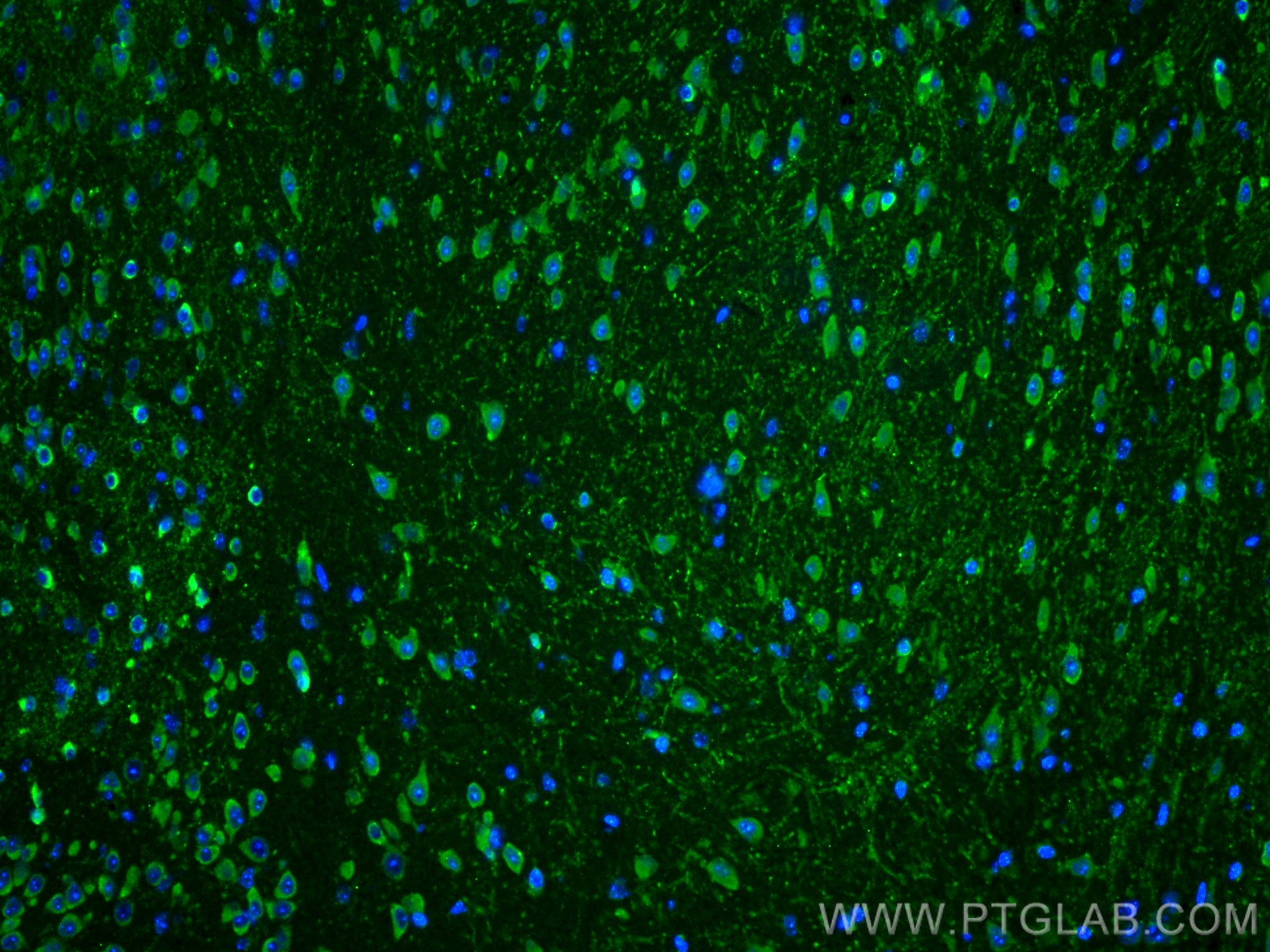 Immunofluorescence (IF) / fluorescent staining of mouse brain tissue using SLC38A9 Polyclonal antibody (21871-1-AP)