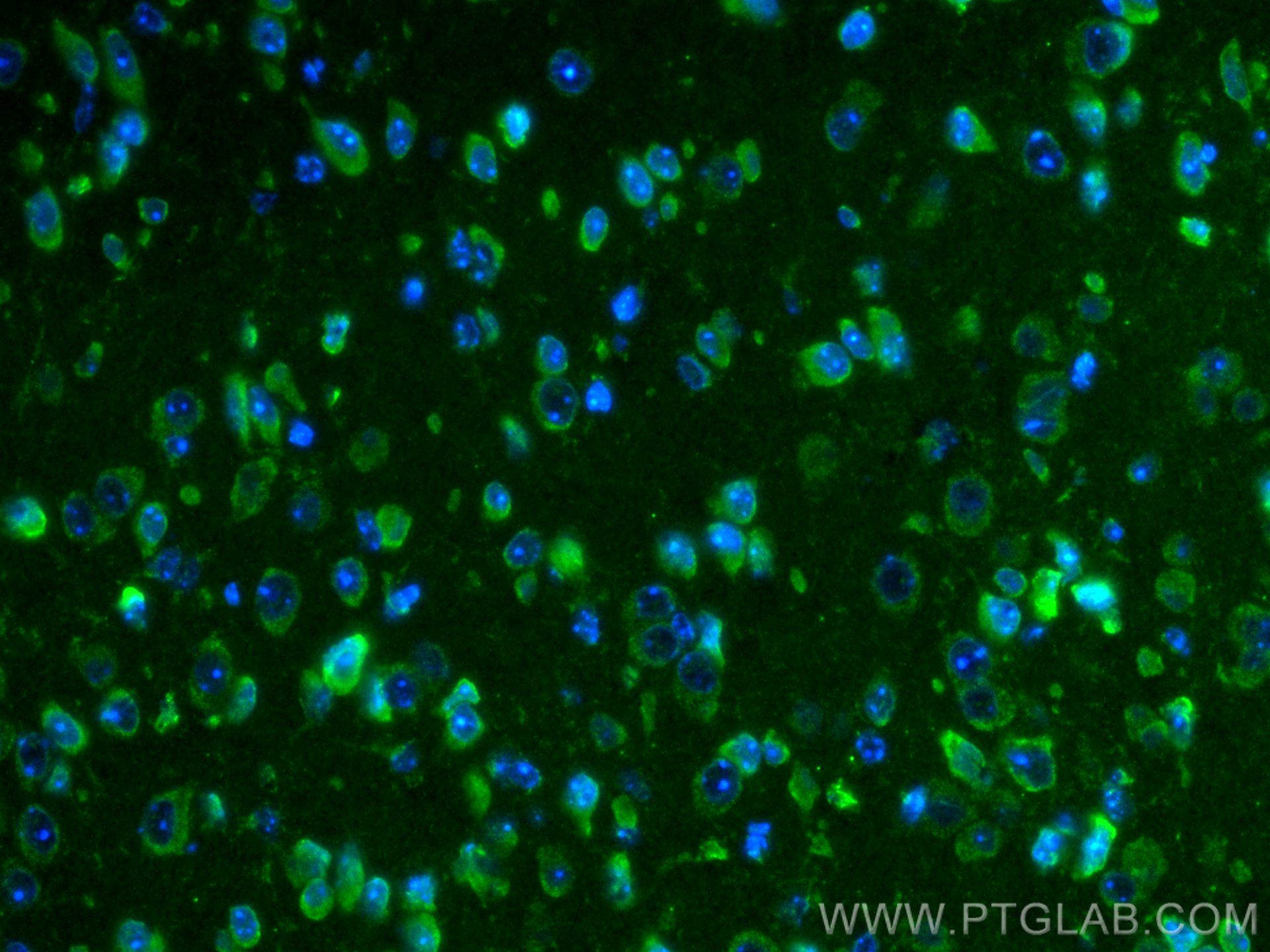Immunofluorescence (IF) / fluorescent staining of mouse brain tissue using SLC38A9 Polyclonal antibody (21871-1-AP)