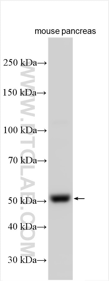 Western Blot (WB) analysis of various lysates using SLC38A9 Polyclonal antibody (21871-1-AP)